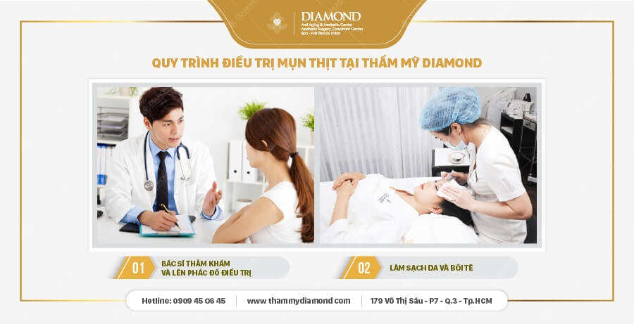 quy trinh dieu tri mun thit, quy trình điều trị mụn thịt tại thẩm mỹ diamond