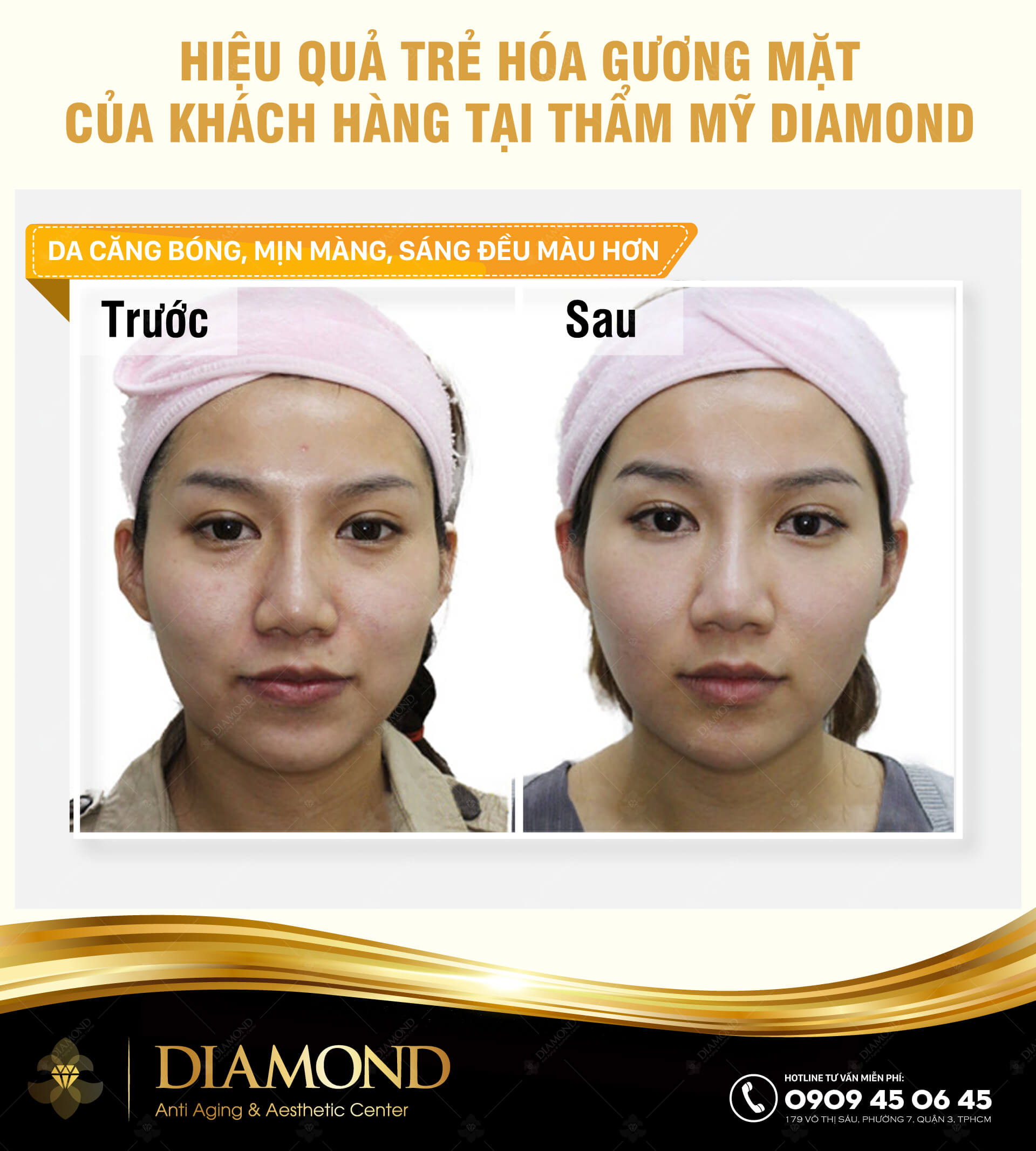 Hiệu quả trẻ hoá gương mặt của khách hàng Diamond