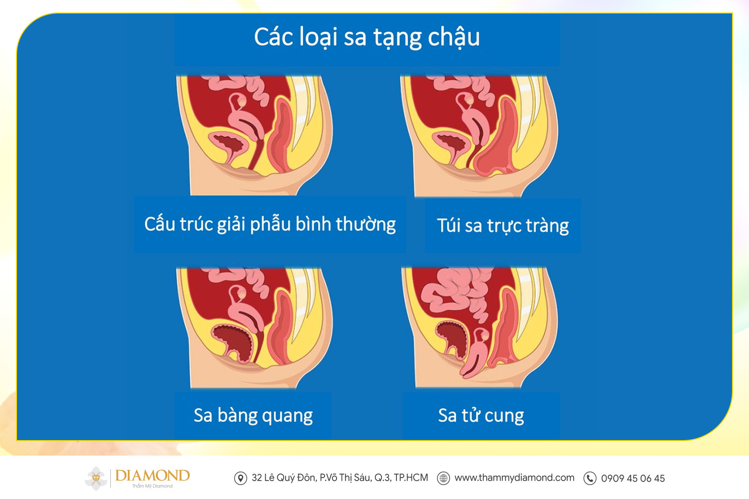 Các loại sa tạng chậu