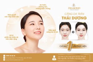 Căng da trán thái dương