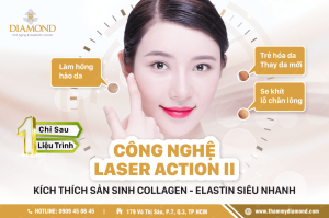 Công nghệ laser actional II
