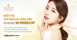 Công nghệ needle DF