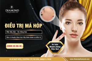 Điều trị má hóp