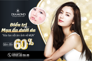 Điều trị mụn ẩn dưới da