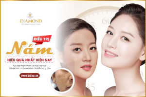 Điều trị nám hiệu quả nhất hiện nay