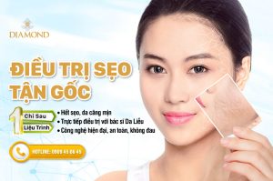Điều trị sẹo tận gốc