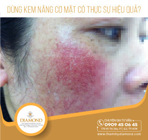 Dùng kem nâng cơ mặt