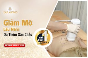 Giảm mỡ lâu năm