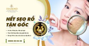 Điều trị sẹo rỗ tận gốc