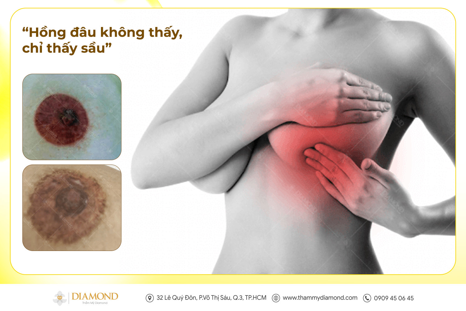 Hồng dâu không thấy, chỉ thấy sầu