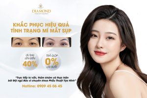 Khắc phục tình trạng mí mắt sụp