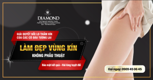 Làm đẹp vùng kín không phẫu thuật cho cô dâu