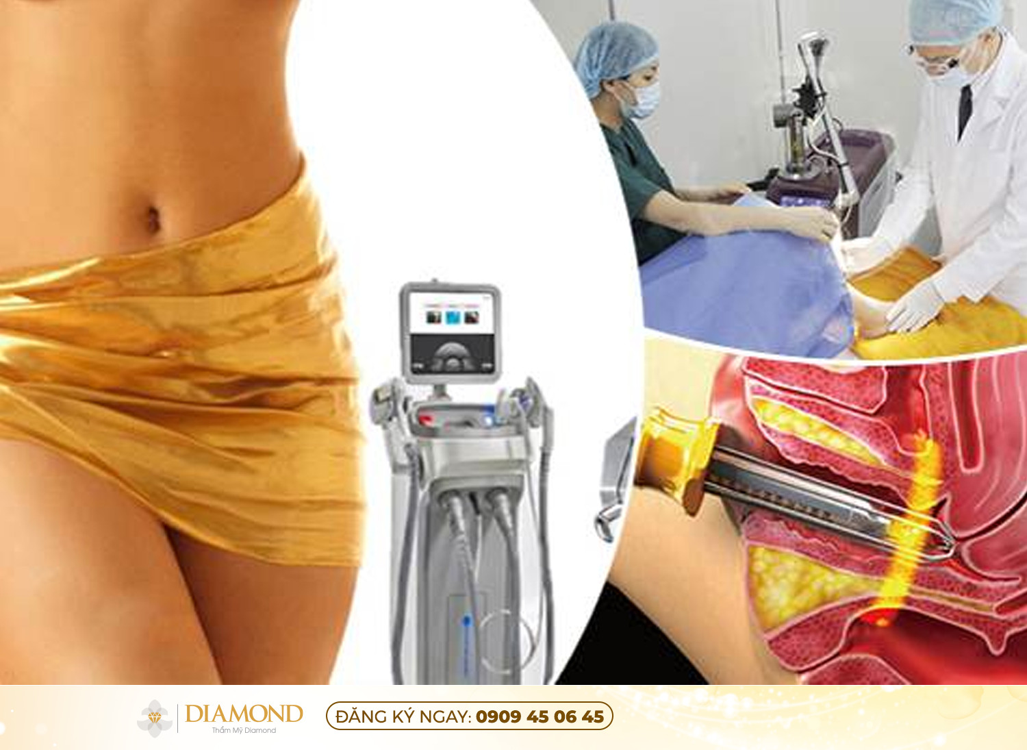 Làm hồng vùng kín bằng Laser