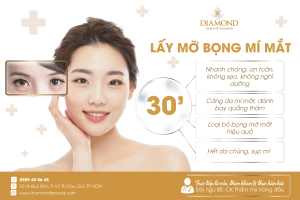 Lấy mỡ bọng mí mắt