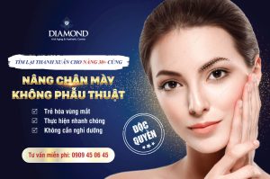 Nâng chân mày không phẫu thuật