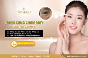 Nâng cung mày không phẫu thuật