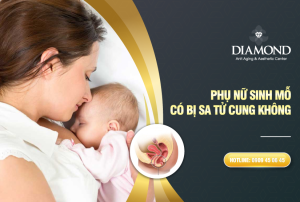 Phụ nữ sinh mổ có bị sa tử cung không