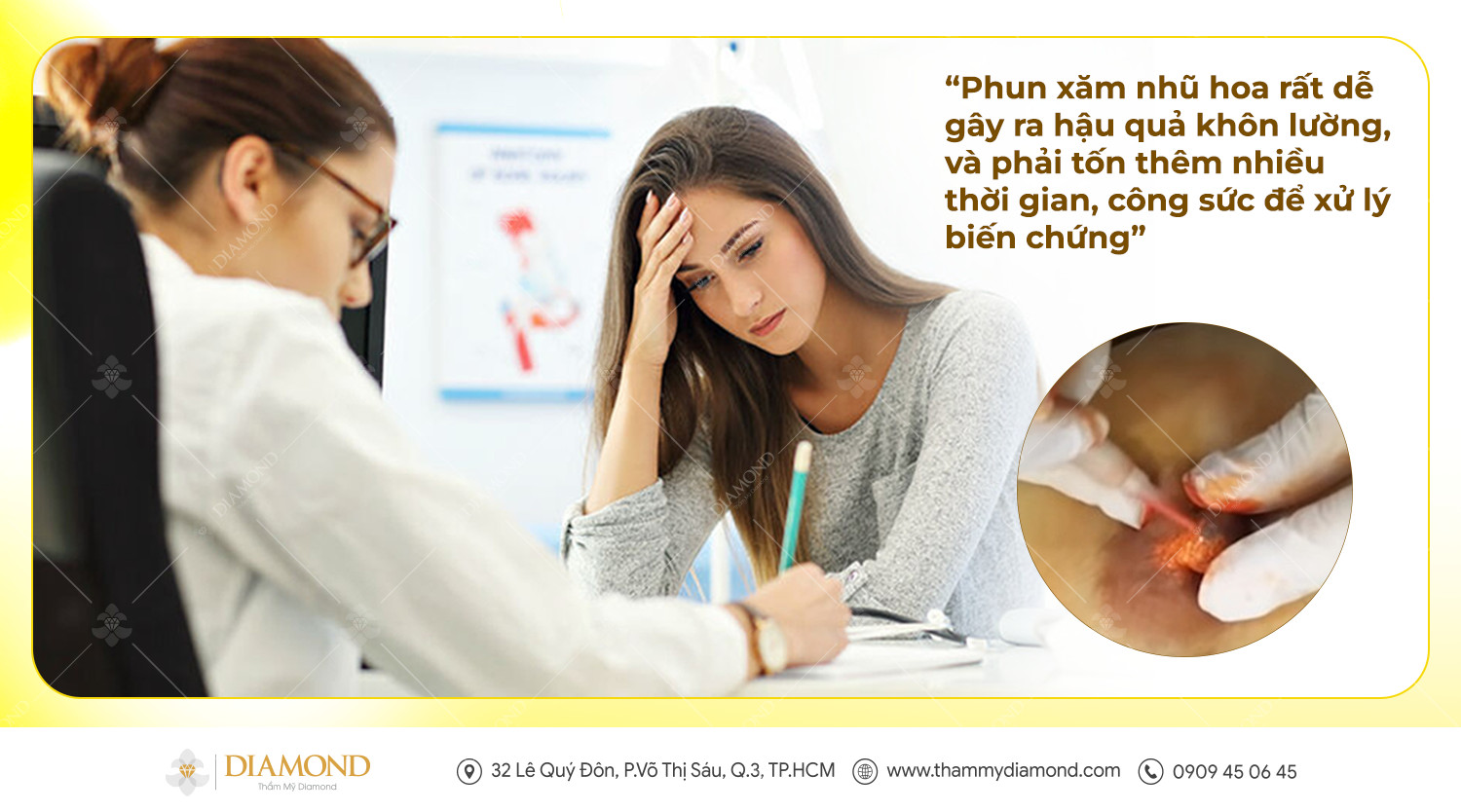 Phun xăm nhũ hoa rất dễ gây ra biến chứng