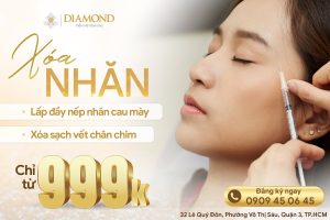 Tiêm xóa nhăn mắt