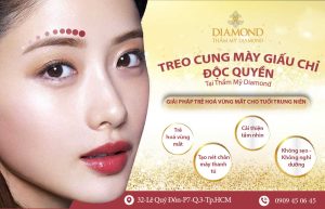 Treo cung mày giấu chỉ