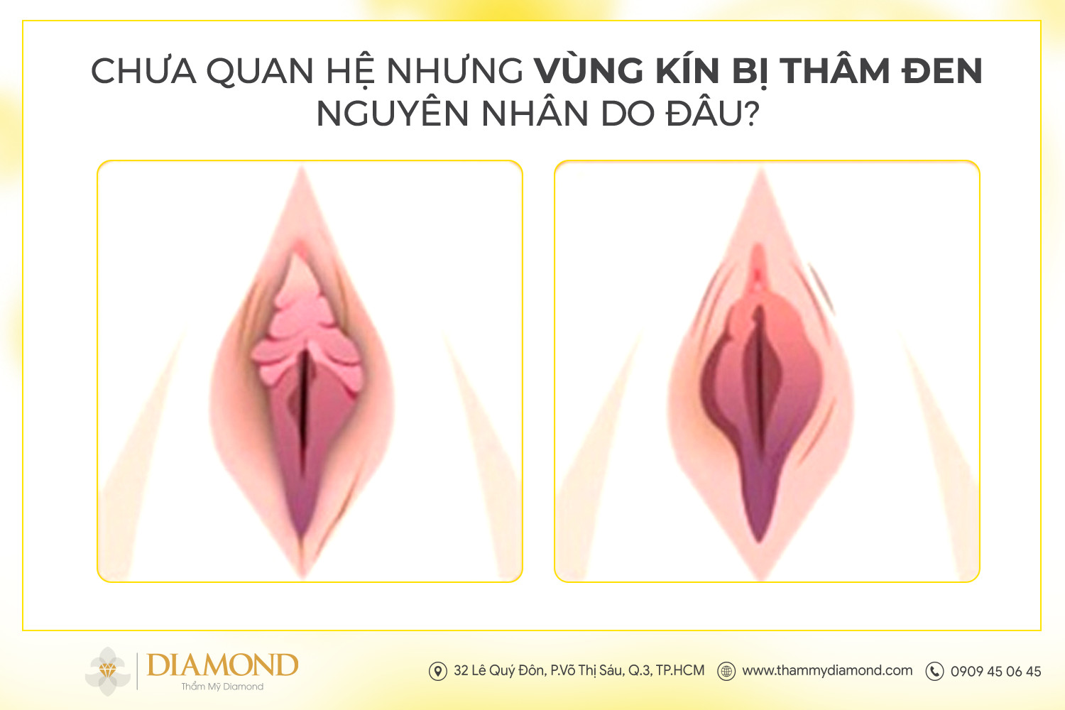 Chưa quan hệ nhưng vùng kín bị thâm đen