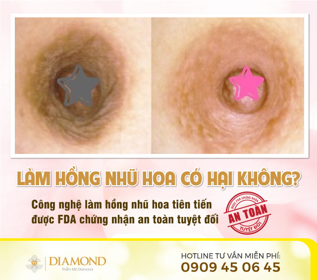 Làm hồng nhũ hoa có hại không?