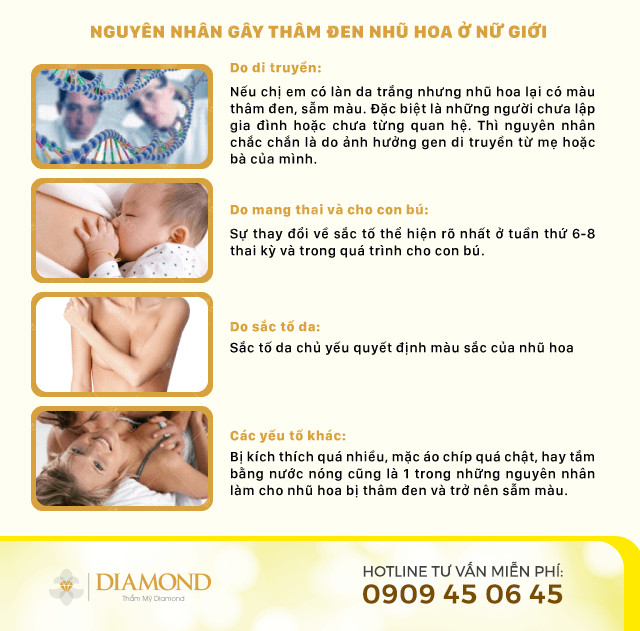 Nguyên nhân gây thâm đen nhũ hoa ở nữ giới