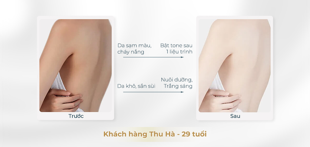 Trước và sau khi chăm sóc body