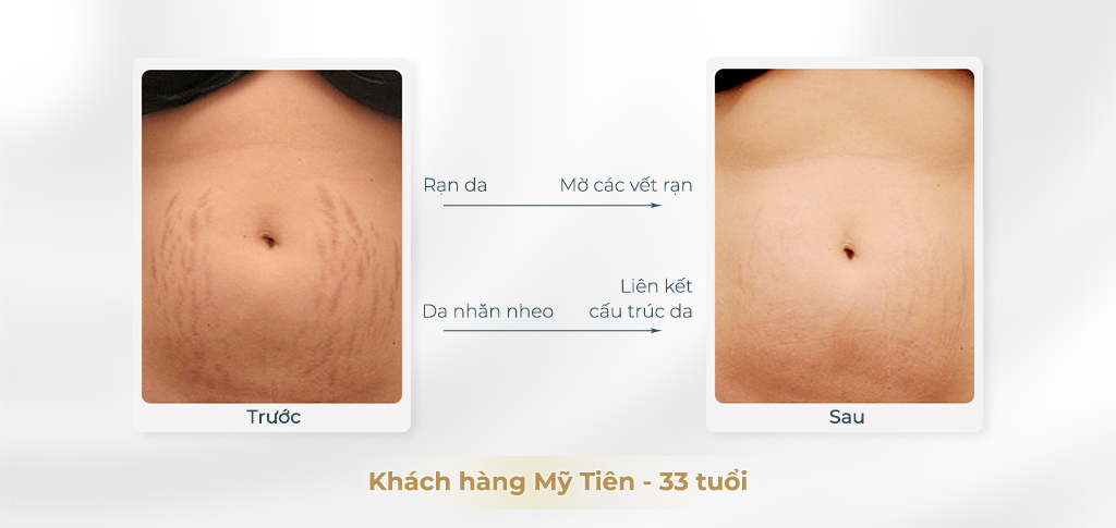 Dịch vụ chăm sóc sau sinh