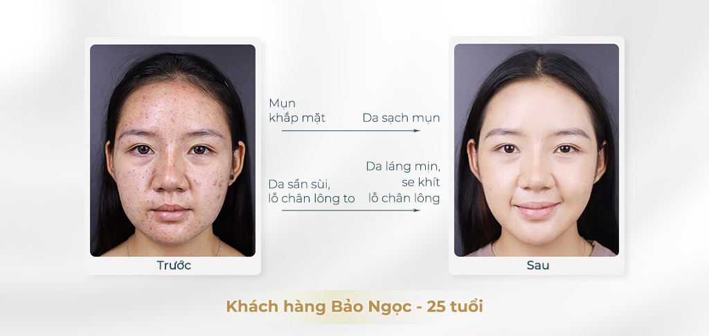 Trước và sau khi điều trị da