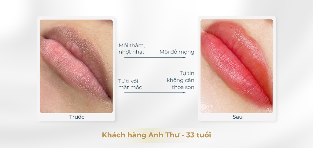 Trước và sau khi phun môi