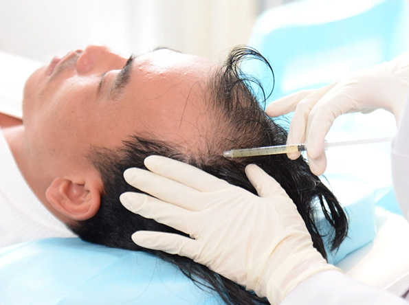 Dịch vụ điều trị hói và rụng tóc