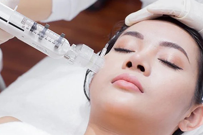 Cấy collagen tươi trị nám