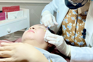 Xóa nhăn công nghệ Mesotherapy