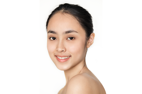 Căng da trán thái dương