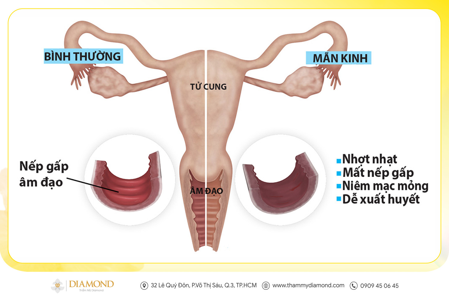 Khô âm đạo - Kẻ thù của "Kỳ trăng mật thứ hai"