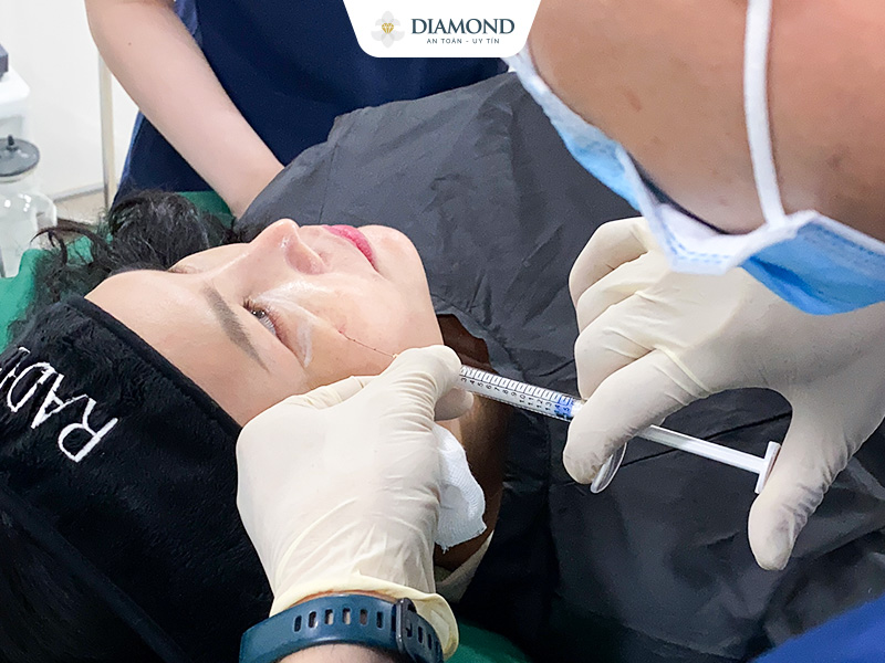 Workshop Về Chất Làm Đầy Radiesse Tại Phẫu Thuật Thẩm Mỹ Diamond