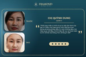 Khách hàng hài lòng sau khi trị nám