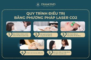 Quy trình điều trị Laser CO2