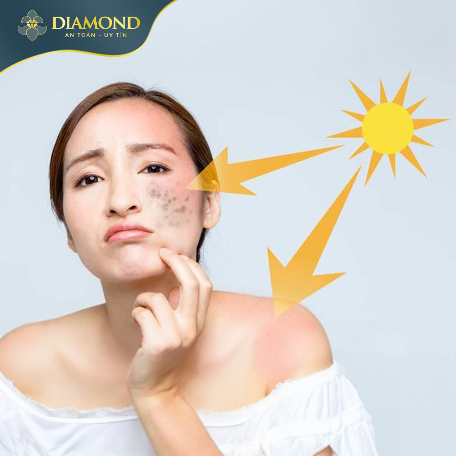 Ánh nắng mặt trời tác động đến da là nguyên nhân có thể gây nám và tàn nhang