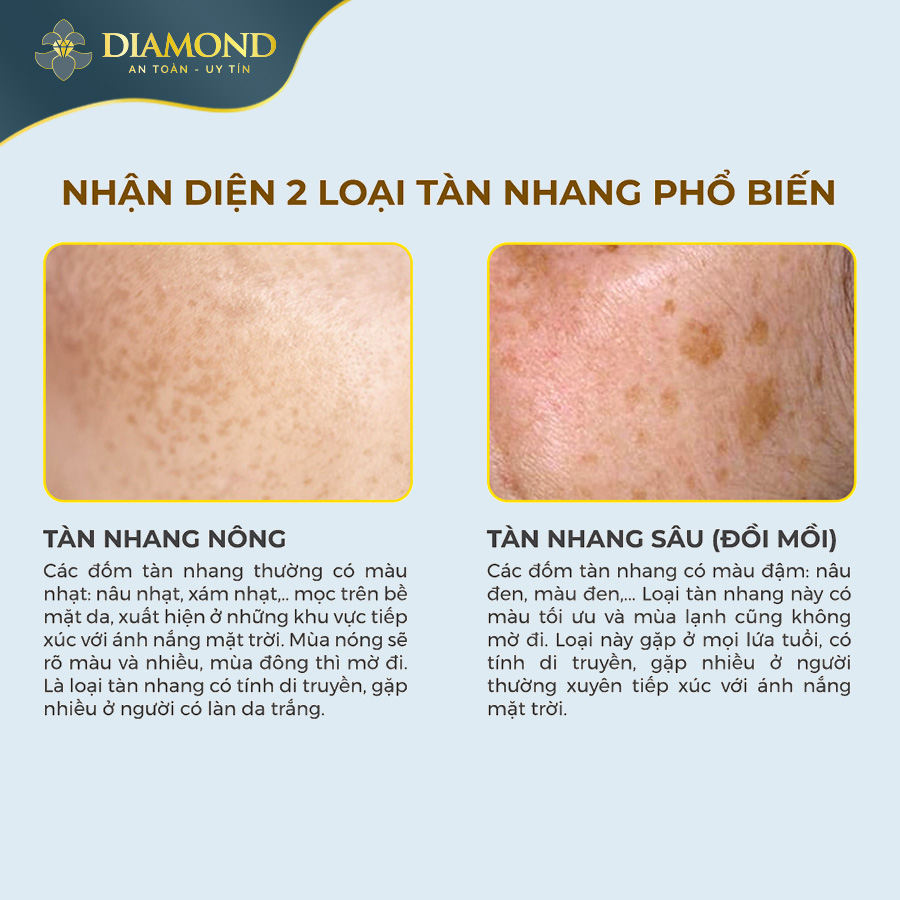Các loại tàn nhang