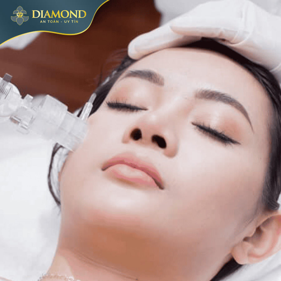 Cấy collagen tươi trị nám