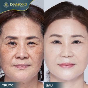 Da căng bóng, mịn màng giúp bạn trông trẻ hơn so với tuổi thật