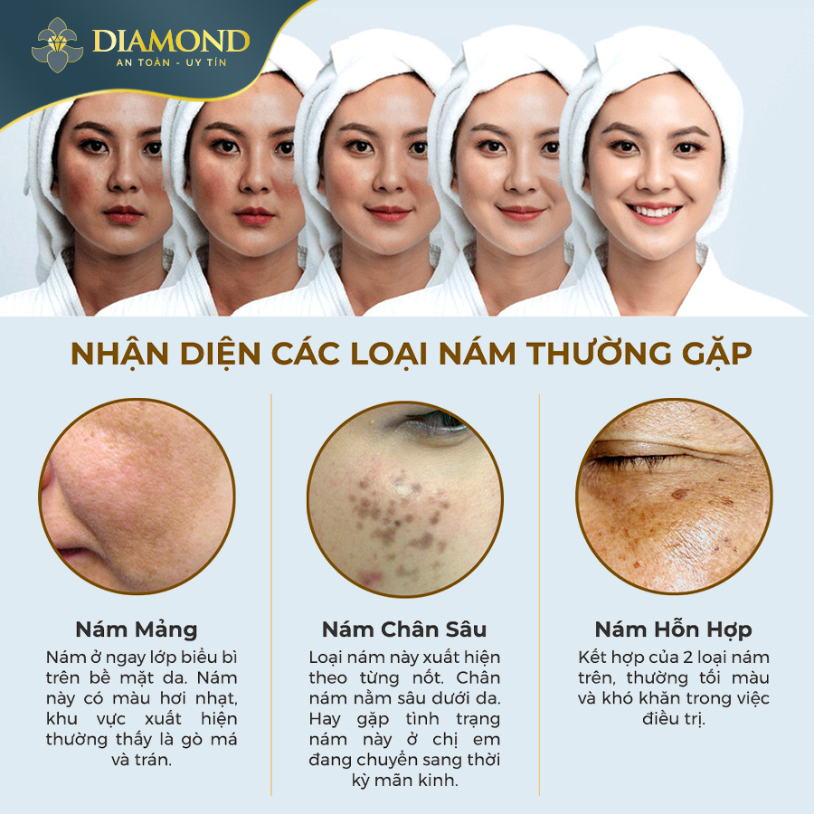 Nhận diện các loại nám thường gặp