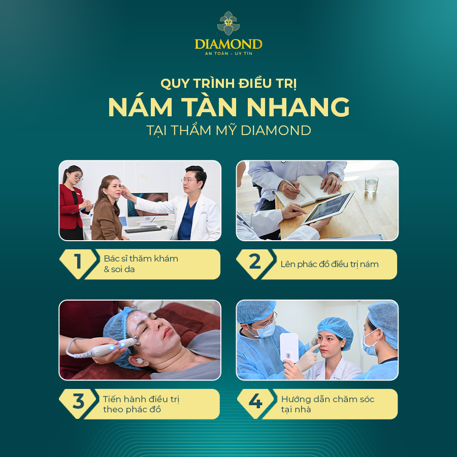 Quy trình điều trị nám tàn nhang tại Thẩm Mỹ Diamond