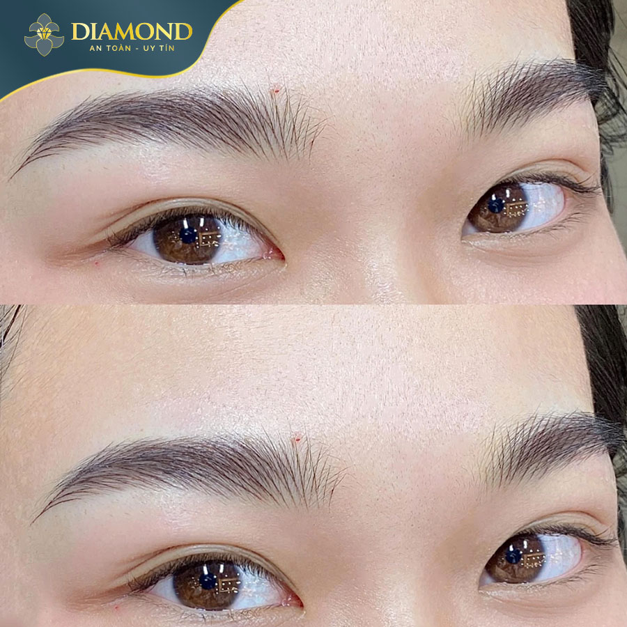 Điêu khắc chân mày Hairstroke phù hợp cho mọi tình trạng chân mày