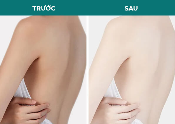 khách hàng ảnh trước sau tắm trắng